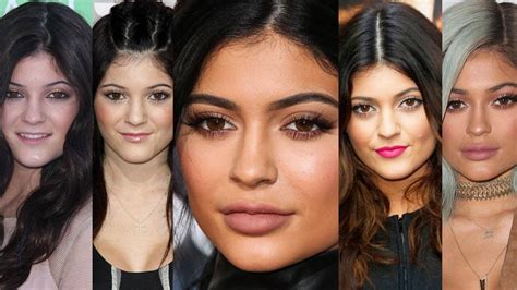 Kylie Jenners Transformation Gallery: See Before